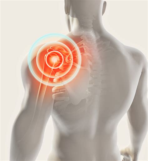 What Is Shoulder Pain? | PainScale