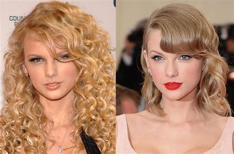 Taylor Swift before and after plastic surgery 05 | Celebrity plastic ...