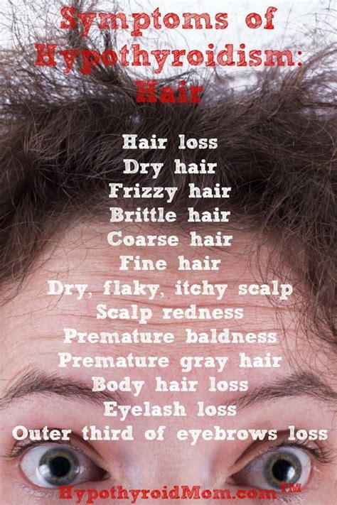 Does Thyroid Hair Loss Grow Back Everything You Need To Know - favorite Men Haircuts