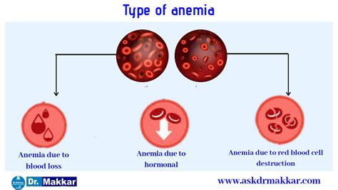 Anemia Homeopathic treatment Dr Makkar India Punjab Mohali