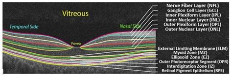 Retinal Layers Oct