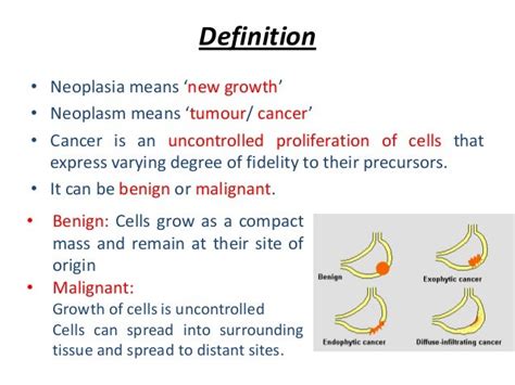 Neoplasia Characteristics and classification of cancer