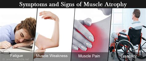 Muscle Atrophy - Causes, Symptoms, Diagnosis, Treatment & Prevention