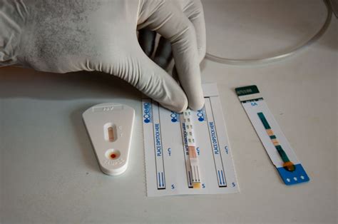 A Simple Guide on Using Home HIV Test Kits – Tests to Diagnose HIV