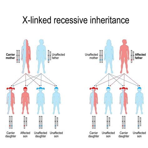 What causes Haemophilia? | The Haemophilia Society