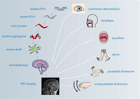 Ataxia Dysmetria