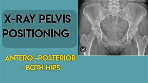 xray pelvis with both hips | pelvis x ray positioning | ap pelvis x ray | ~ enjeela shafat - YouTube