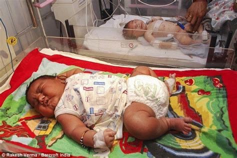 Biggest baby ever born in India is a massive 13lb | How big is baby, Baby, Newborn baby