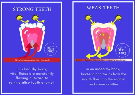 Is tooth remineralization possible? - Meliors Simms- Holistic Tooth Fairy