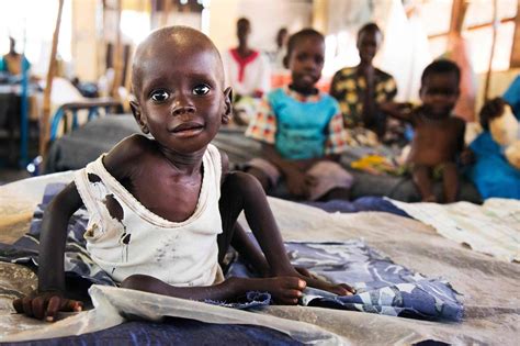 Children fleeing South Sudan war suffer 'severe malnutrition'