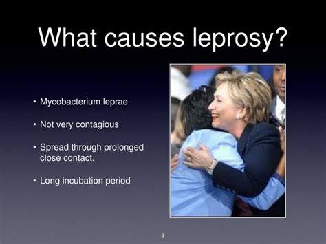 PPT - Leprosy PowerPoint Presentation - ID:3060390