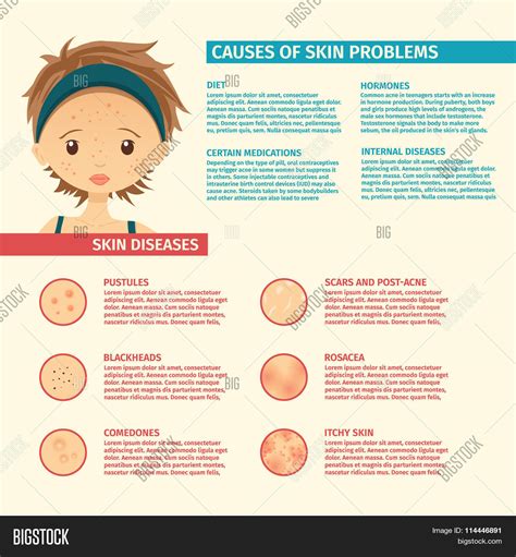 Infographics Skin Vector & Photo (Free Trial) | Bigstock