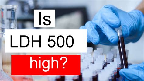 Is LDH 500 high, normal or dangerous? What does Lactate dehydrogenase level 500 mean?