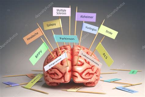 Brain Degenerative Diseases — Stock Photo © ktsdesign #110106742