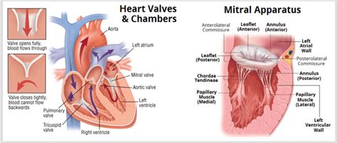 Basic anatomy of heart valves and chambers (mitral valve apparatus ...