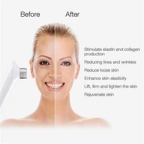 MLAY RF Radio Frequency Facial And Body Skin Tightening Machine ...