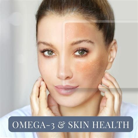 Skin Health with Omega-3