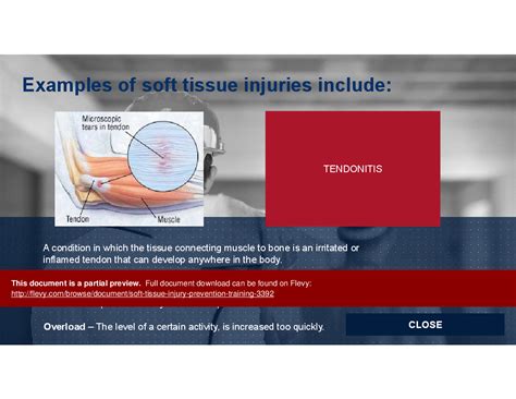 PPT: Soft Tissue Injury Prevention Training (35-slide PPT PowerPoint presentation PPTX) | Flevy