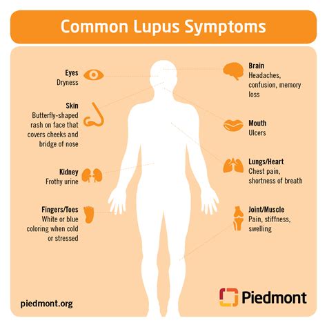 Lupus Causes, Symptoms and Treatment Information | Piedmont Healthcare