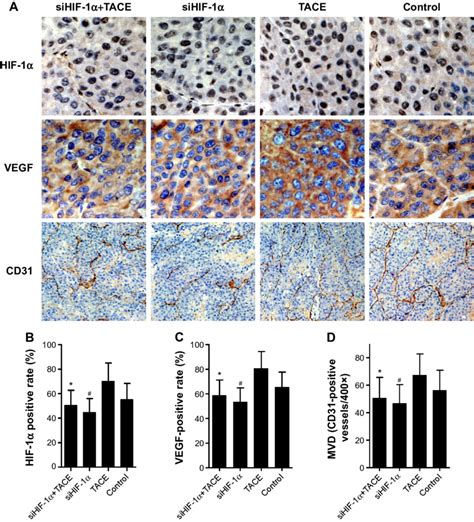 immunohistochemical analysis. Notes: (A–D) immunohistochemical analysis... | Download Scientific ...