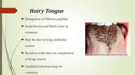 Diseases of lips & tongue