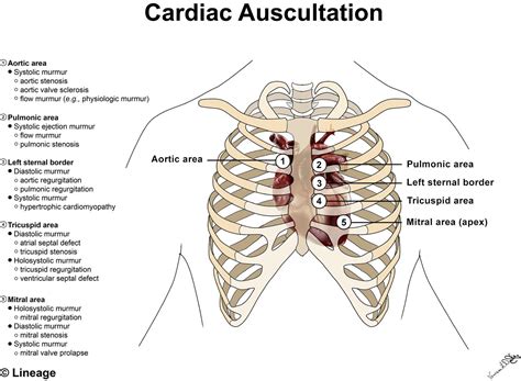 Aortic Regurgitation Murmur