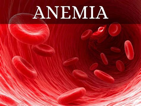 Anemia: 10 Symptoms of Anemia