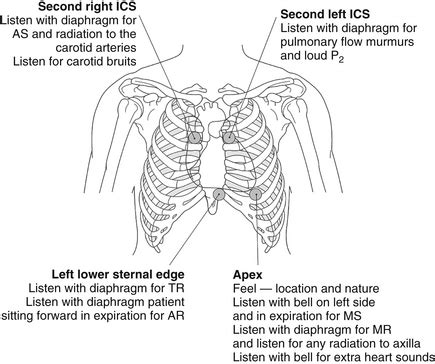 Heart Murmurs | Thoracic Key