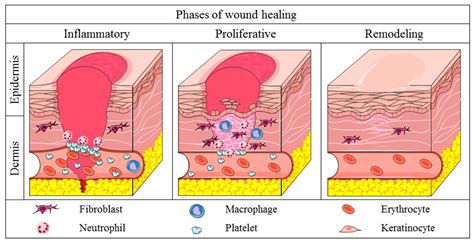 Stages of Wound Healing