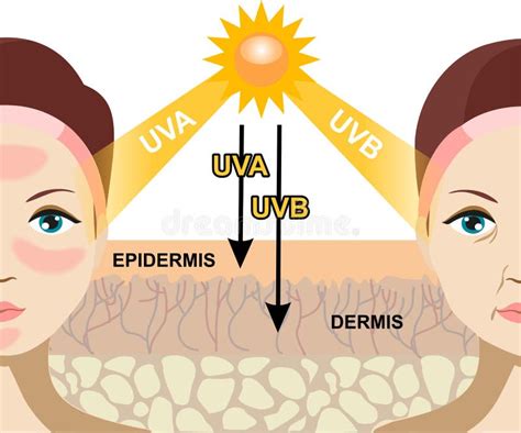 UV radiation and the skin. stock vector. Illustration of bright - 88088311