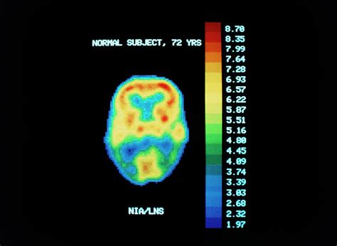 Pet Scan Of Brain Of Normal Subject Photograph by National Institute Of Health/science Photo ...