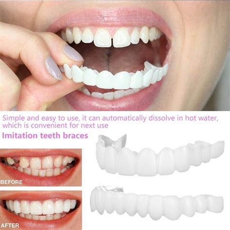 HOTBEST Smile eneers Snap On Upper False Teeth Dental eneers Dentures Tooth Coer White Teaching ...