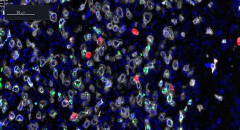 Multiplex Assays and Multiplex Immunoassays | Bio-Techne