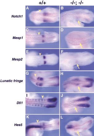 The murine winged helix transcription factors, Foxc1 and Foxc2, are both required for ...