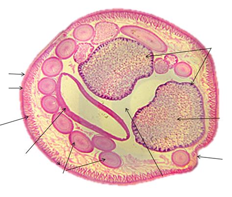 Female Ascaris Cross Section Diagram | Quizlet