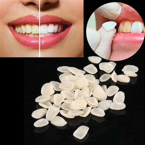 Dental Teeth Veneers Ultra Thin Whitening Resin Anterior Upper Temporary Crown Porcelain Dental ...