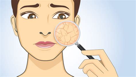 Dry Skin in Malaysia: How to Treat Using Moisturizer