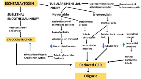 Pathology of Acute tubular injury/necrosis - Pathology Made Simple