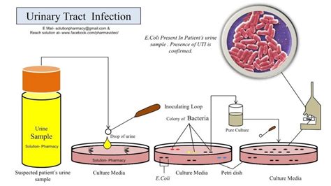 Urine Culture Test: Price, Result, Need, and Normal Range