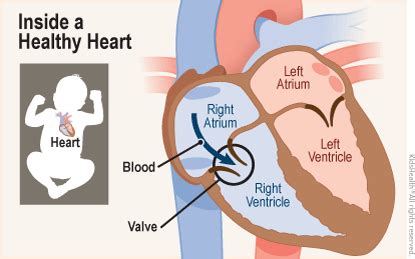 Dictionary: Right Ventricle (for Parents) - Children's Health System - Alabama (iFrame)