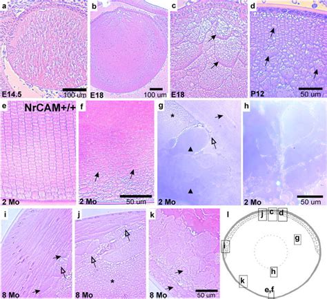 Cataract histology of NrCAM-deficient mice. From the emergence of... | Download Scientific Diagram