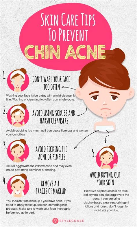 How To Get Rid Of Chin Acne - SylviaWeems