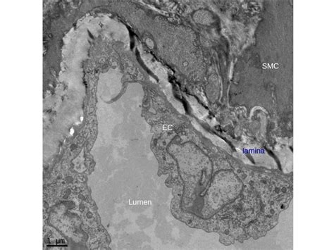 What could be preventing the basal lamina from being preserved in mouse aortic ring electron ...