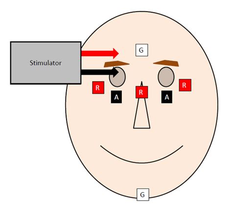 Blink Reflex - Physiopedia