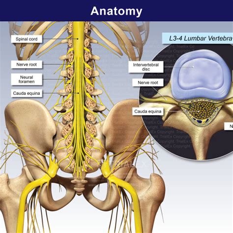 Medical Legal Exhibits - Legal Animations & Trial Graphics - Tria...