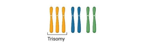 Aneuploidy: Definition, Types, Causes, and Examples