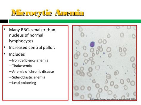 Lead Poisoning Anemia