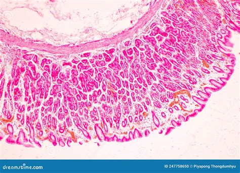 Tissue of Stomach Human Under the Microscope in Lab. Stock Photo ...