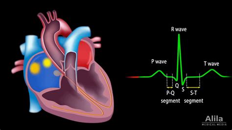 What PR, QRS, and QTc Intervals Mean on Your Watch ECG | Qaly