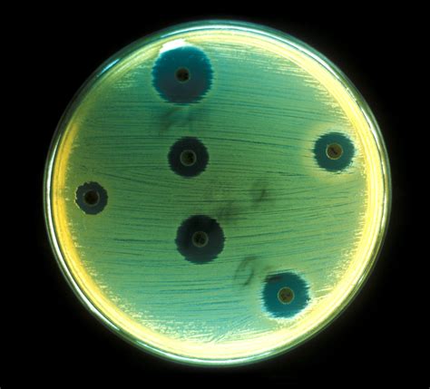 Free picture: aerobic, bacteria, staphylococcus aureus, cultured, agar ...